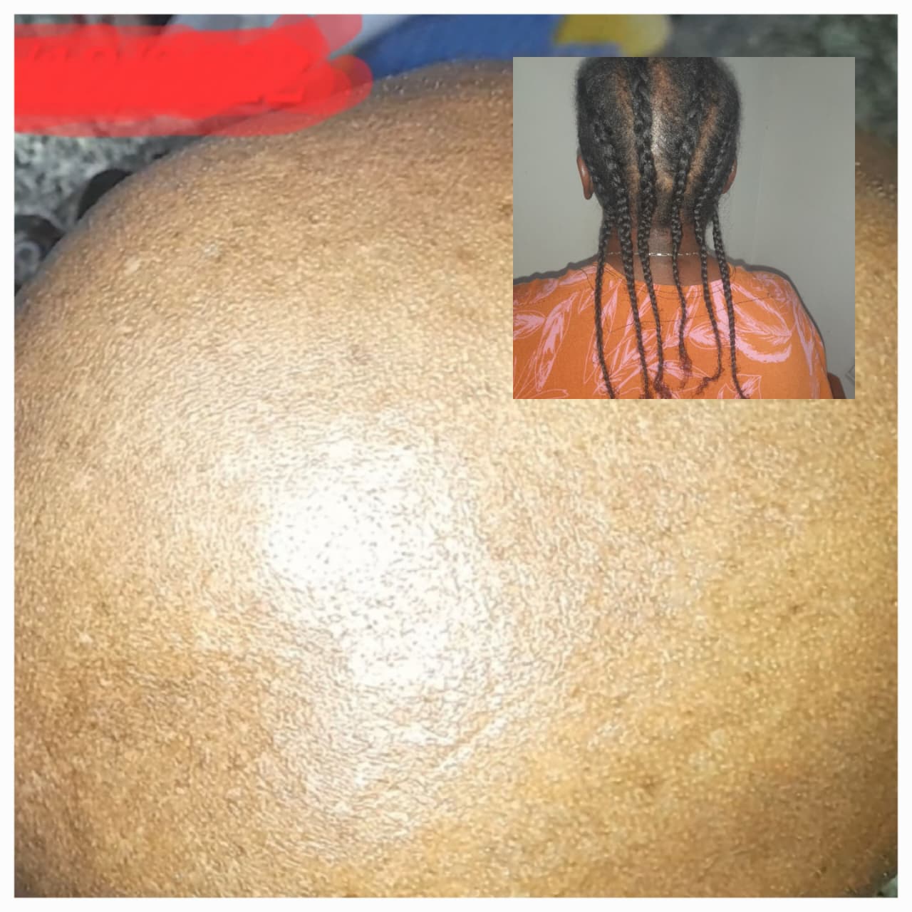 Avant/Après Amira Beauty